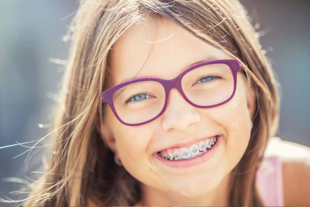 Brackets autoligables, metálicos y estéticos Udemax