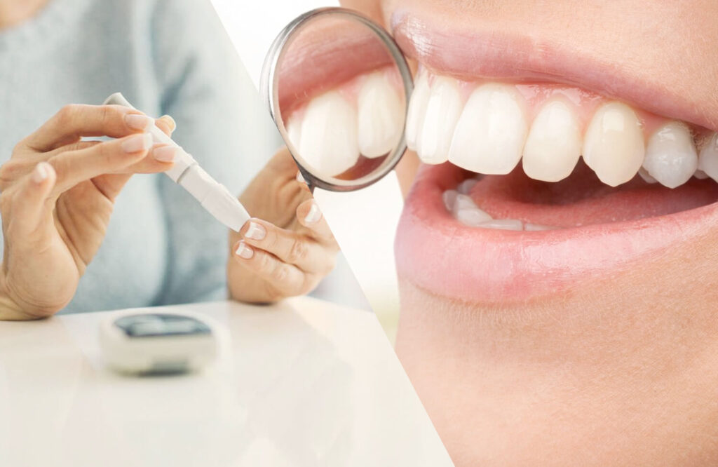 Diabetes y la salud dental.
